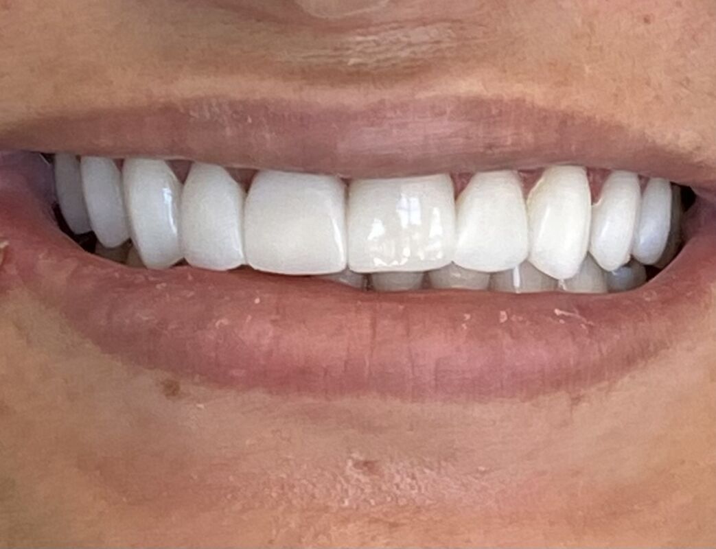 Detalhe do sorriso de paciente da A&A Dental Clinic